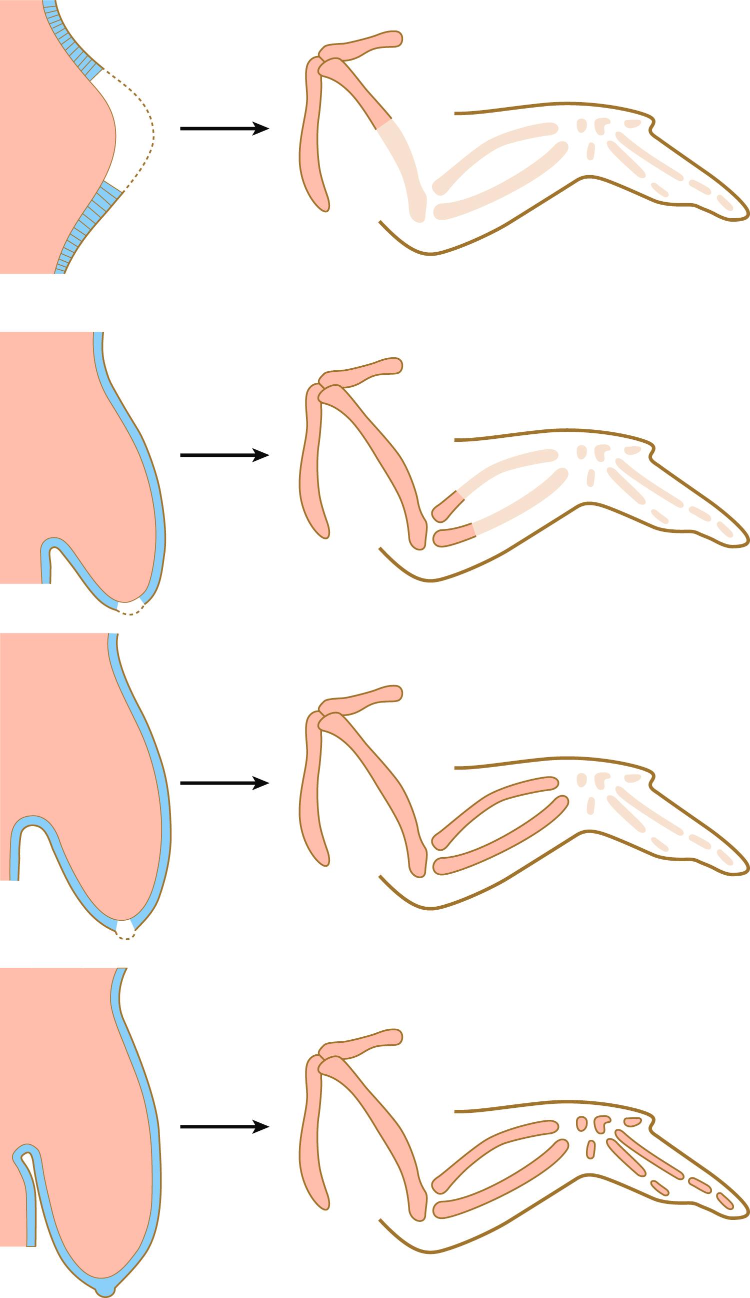 Fig. 10.8, Top three , Effect of removing the apical ectodermal ridge at successively later stages on the development of the avian wing bud. The more mature the wing bud, the more skeletal elements form after apical ridge removal. Missing structures are shown in light gray . Bottom , Normal development of an untouched wing bud.