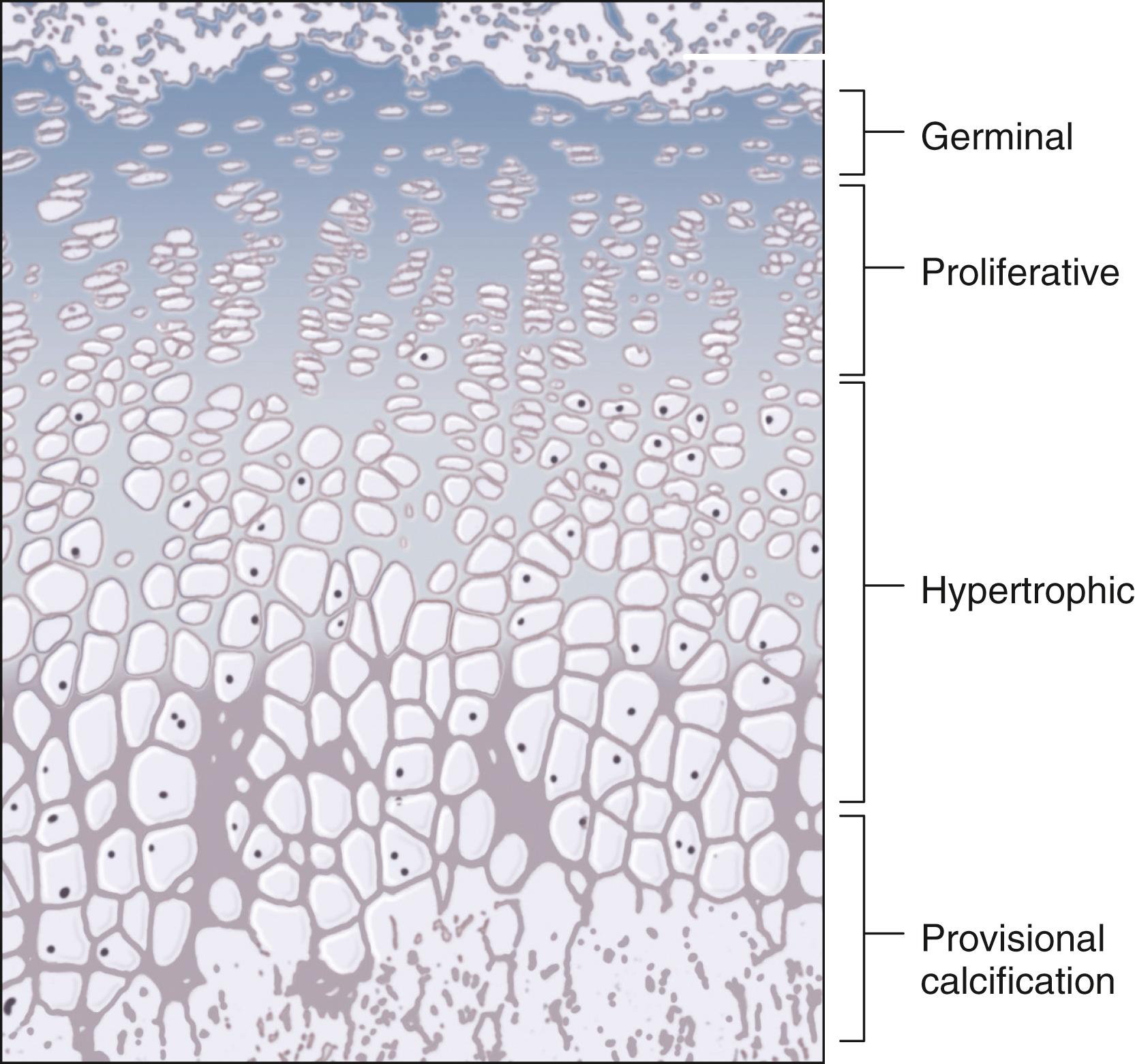 Fig. 20.11, Scheme of organization of the growth plate, or physis. The histologically identifiable layers include the resting or germinal layer and the proliferative, hypertrophic, and provisional calcification layers progressing from epiphysis to metaphysis.