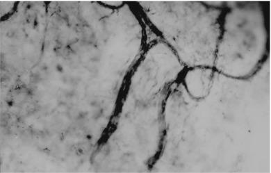 Fig. 15.4, Whole-mount gold chloride preparation of anterior limbal vessels showing two vessel spike formations.