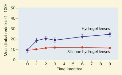 Fig. 15.6, Mean change in limbal redness grade over time for silicone hydrogel lenses (red line) and conventional hydrogel lenses (blue line). (Approximate scale: 0 = trace redness; 100 = extreme redness).