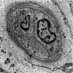 Fig. 15.8, Electron micrograph of a limbal conjunctival capillary displaying a closed lumen.