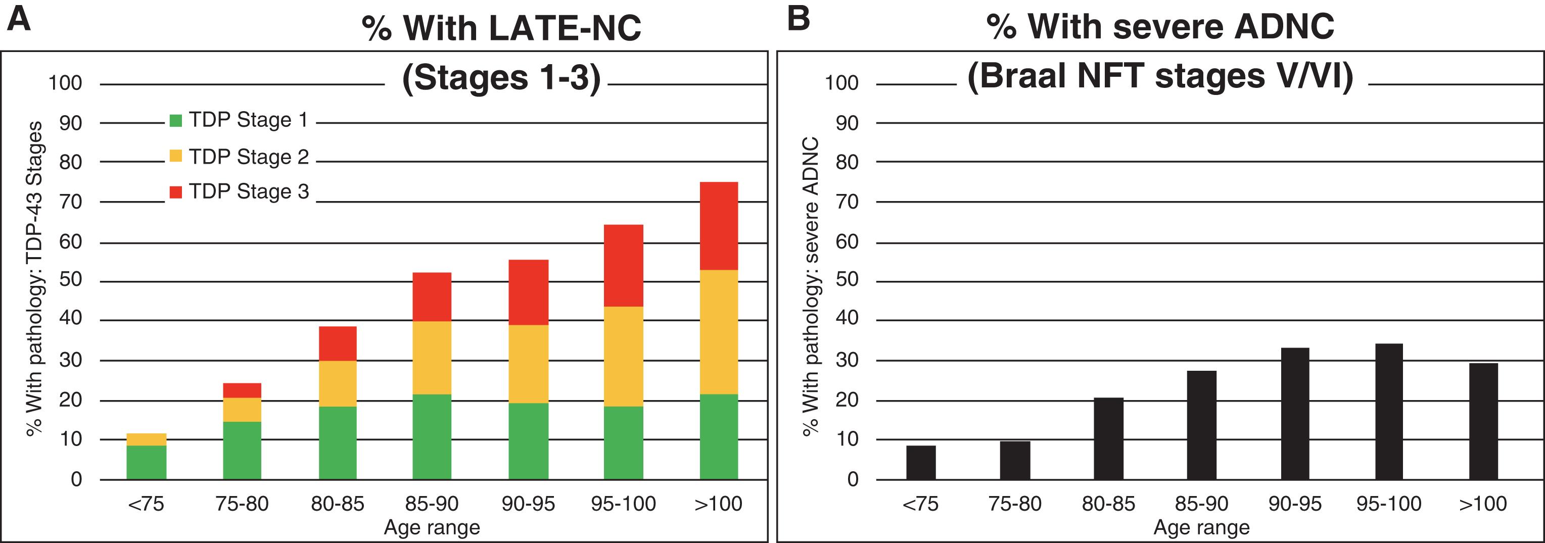 Fig. 6.1, Prevalence of limbic-predominant age-related TDP-43 encephalopathy neuropathologic change ( LATE-NC ) (A) compared with severe Alzheimer’s disease neuropathologic change ( ADNC ) (B) stratified by age in a community-based cohort (Rush University, n = 1376). NFT, Neurofibrillary tangle; TDP , TDP-43.