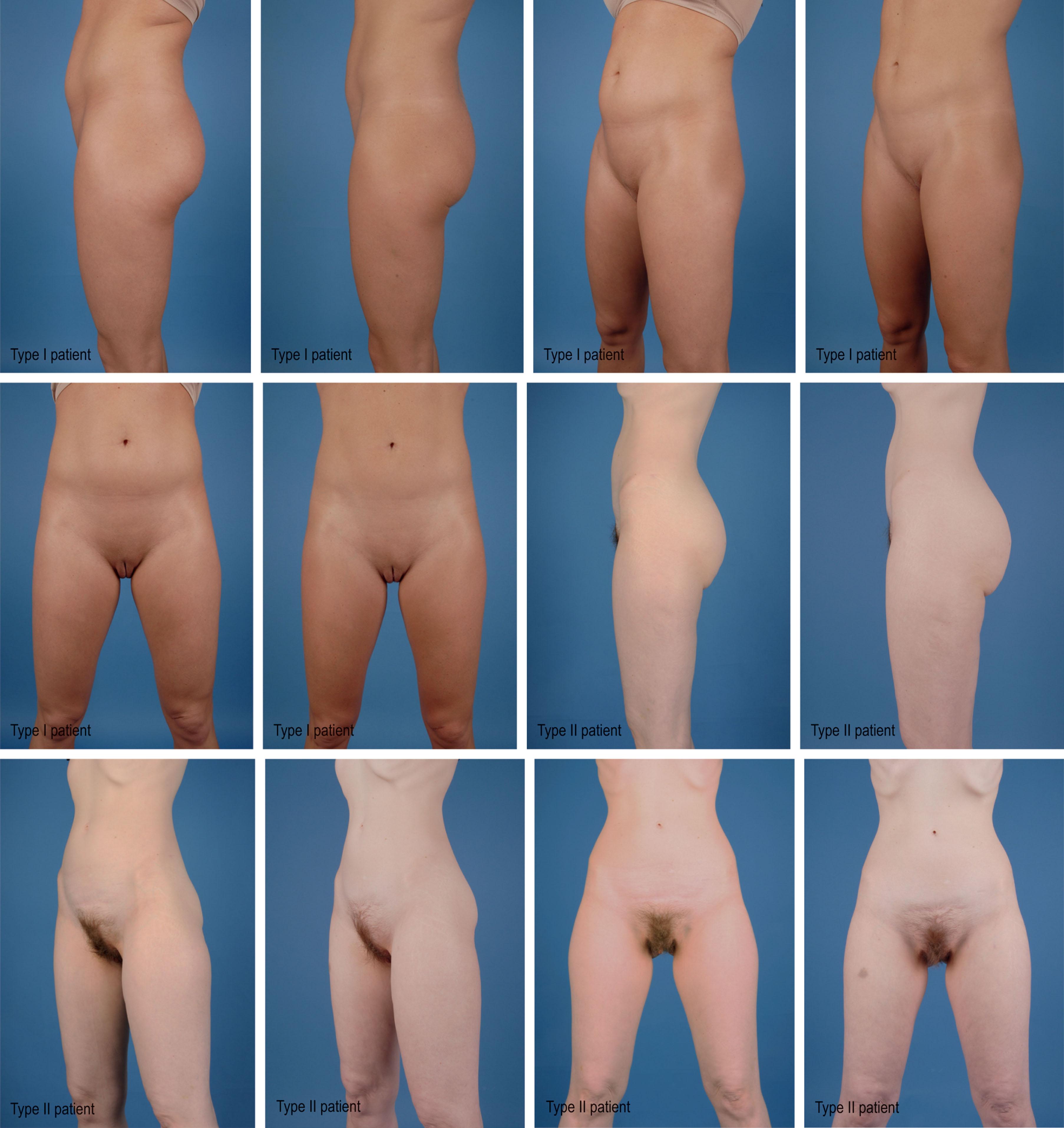 Figure 25.2.3, Patient examples of three types of patients (I–III): first six images, patient type I; second six images, patient type II;Figure 25.2.3, cont’d third six images, patient type III.