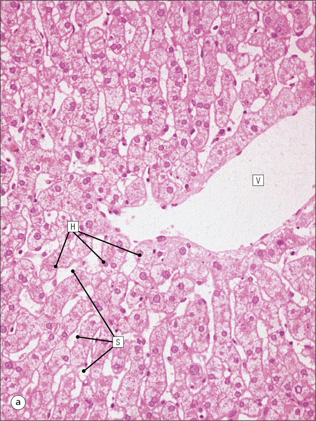 Fig. 12.3, Hepatic Sinusoids.