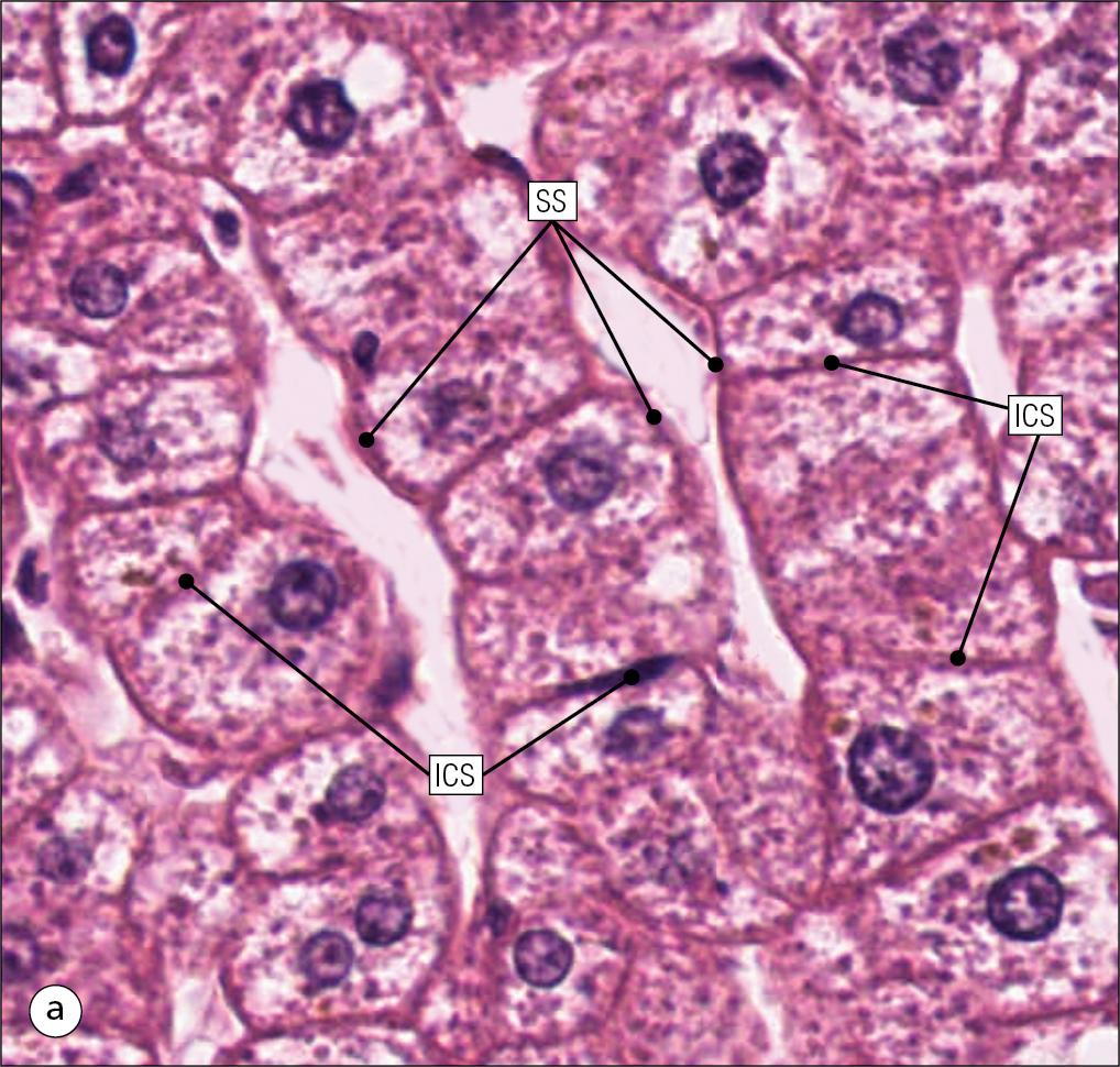 Fig. 12.6, Hepatocyte.