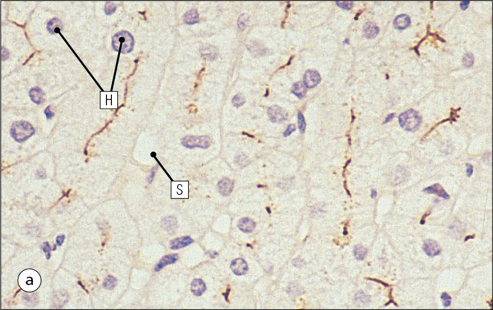 Fig. 12.7, Bile Canaliculi.