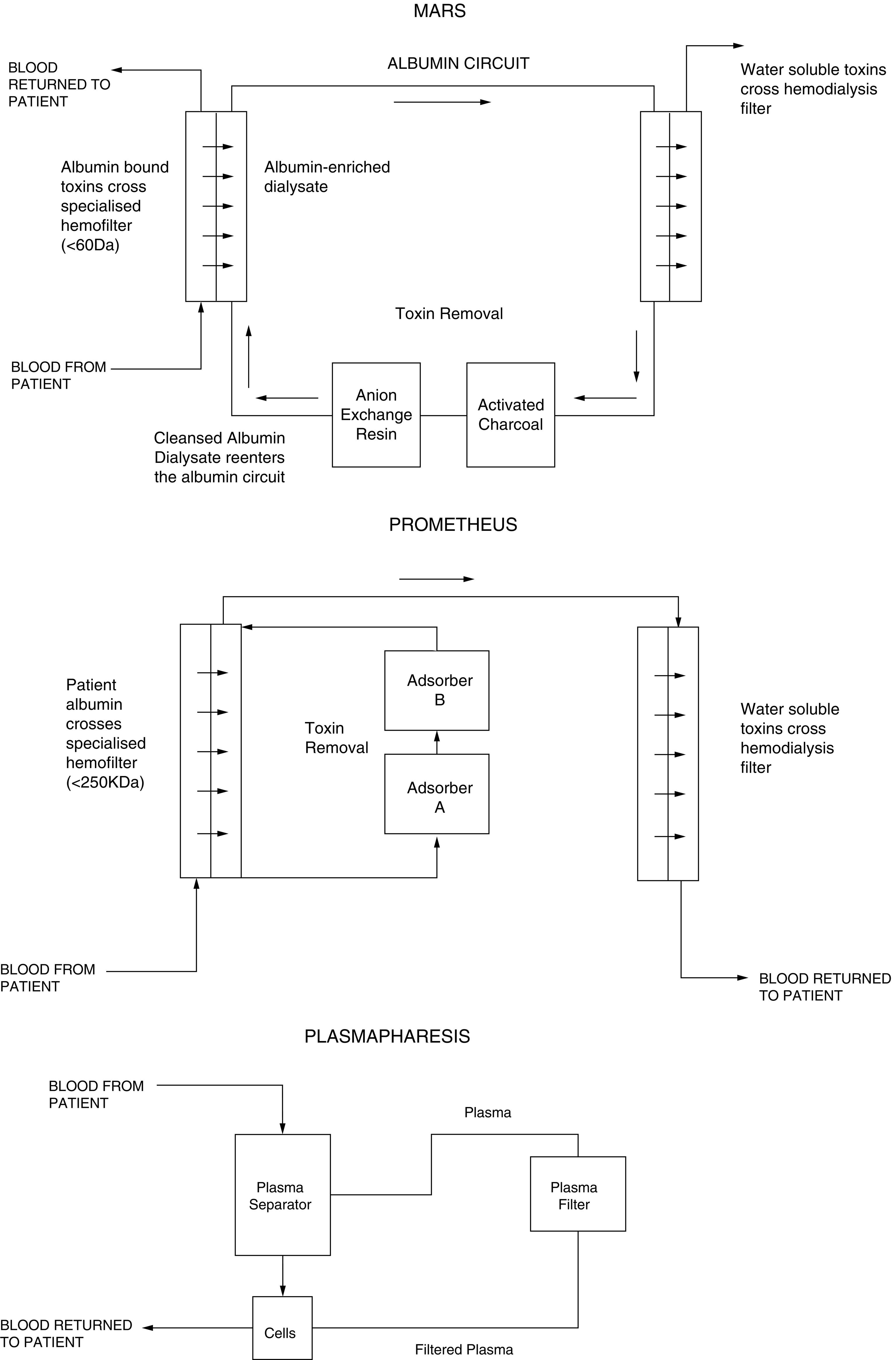 Fig. 31.1, Schematic illustration of (a) MARS, (b) Prometheus, and (c) plasmapheresis circuits.