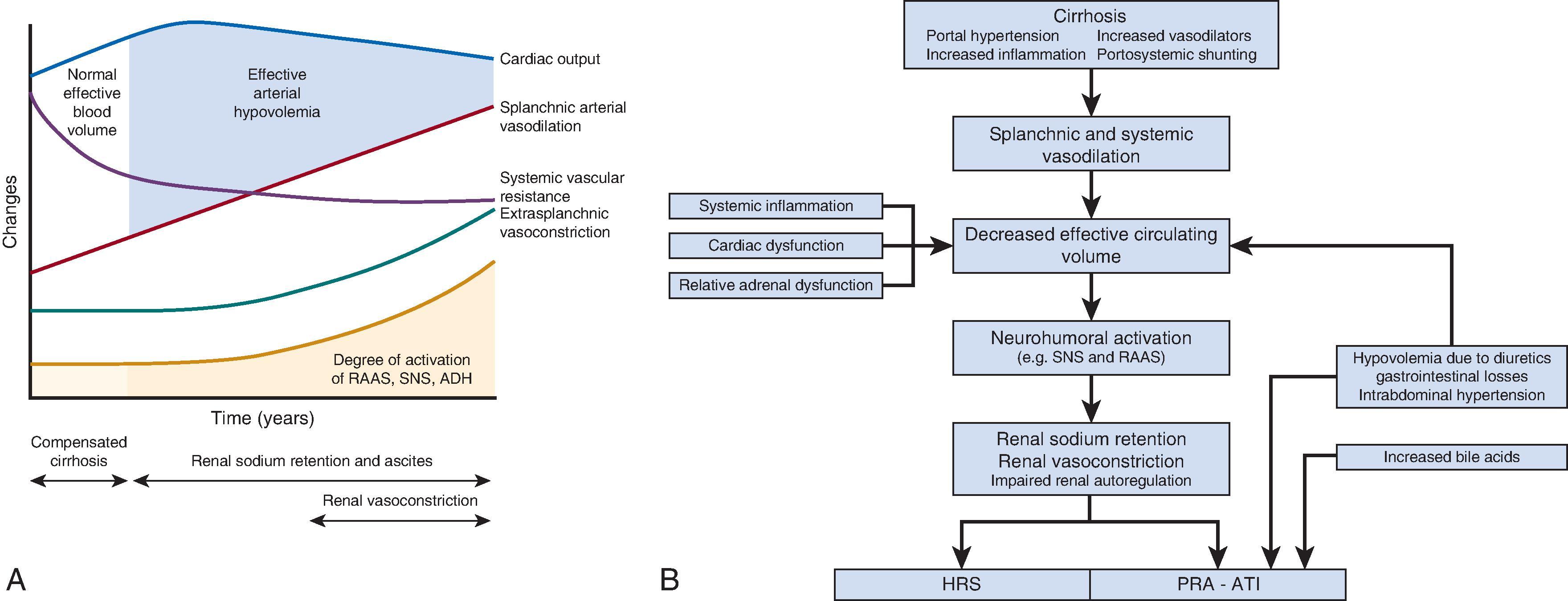 Fig. 30.1, (A) Temporal evolution of the hemodynamic, neurohumoral, and renal functional changes occurring in patients with cirrhosis. (B) Summary of the hepatorenal pathophysiologic changes occurring in cirrhosis that predispose to hepatorenal syndrome and acute kidney injury (AKI). (A adapted from Arroyo V, Fernández J. Management of hepatorenal syndrome in patients with cirrhosis. Nat Rev Nephrol. 2011;7:517–526.)