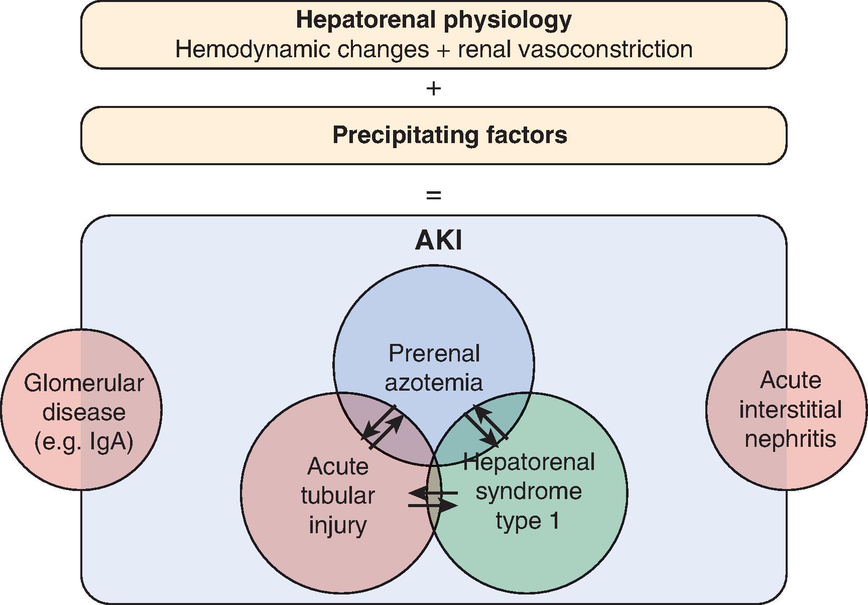 Fig. 30.2, Schematic representation of the distinct overlapping pathogenic mechanisms that may be present and contributing to acute kidney injury (AKI) in patients with cirrhosis.