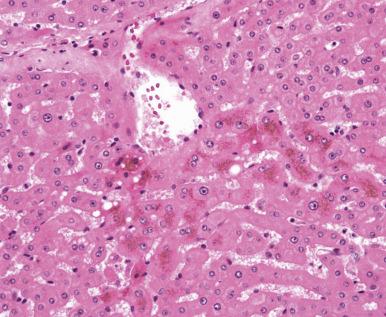 Figure 19.1, Lipofuscin appears as a finely granular brown pigment within hepatocytes, most prominent in zone 3.