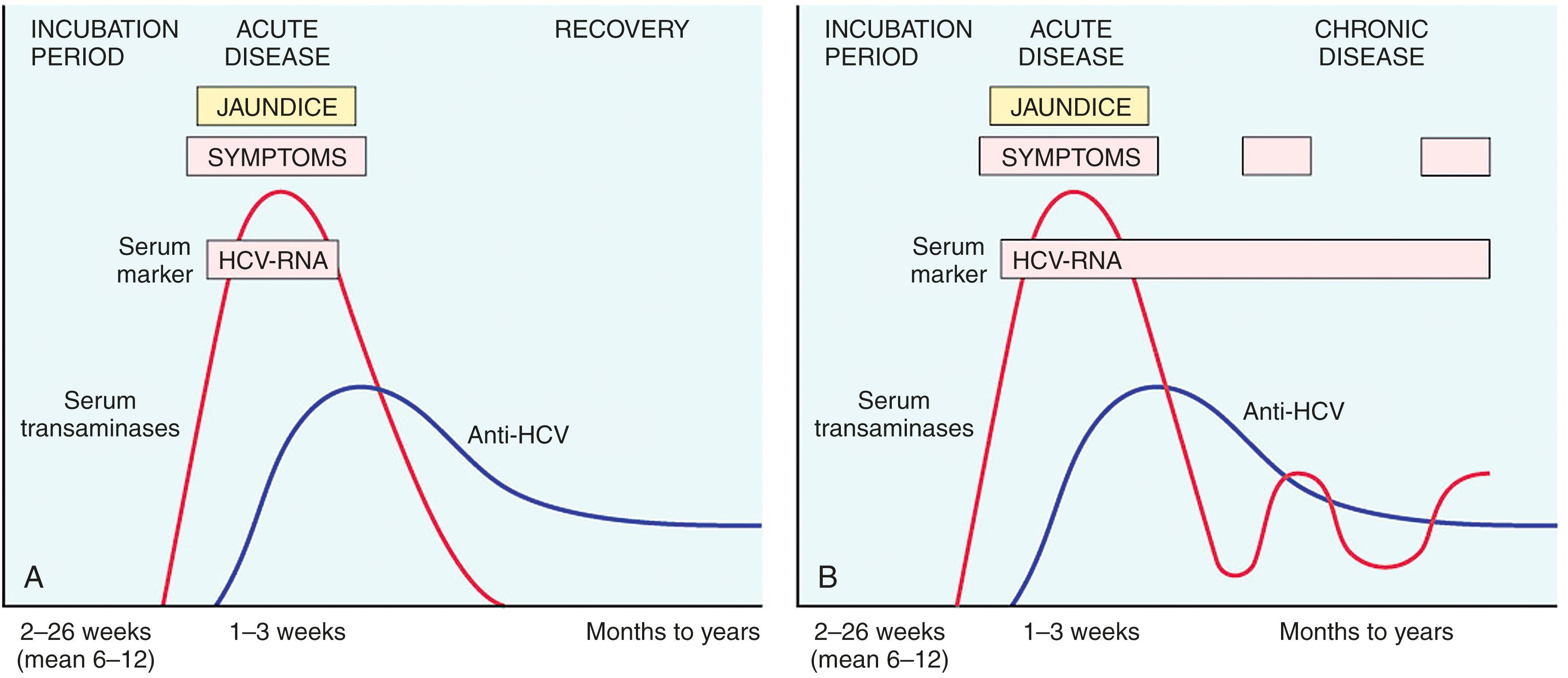 FIG. 14.12, Temporal changes in serologic markers in hepatitis C infection. (A) Acute infection with resolution; (B) progression to chronic infection.