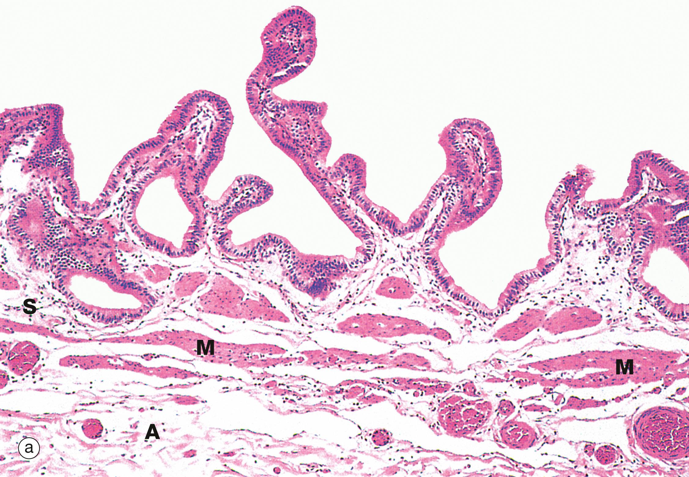 Fig. 15.13, Gallbladder