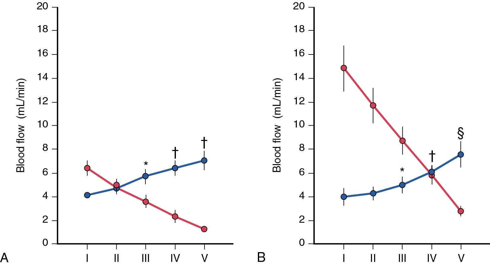 FIGURE 5.6, Hepatic arterial buffer response in cirrhotic (A) and control livers (B). Upon reduction of portal venous blood flow (red), there is a constant increase of hepatic arterial blood flow (blue). The portal flow is markedly diminished in cirrhotic liver, but the buffer response is preserved. Values are means ± standard error of triplicate measurements per animal ( n = 6). * P < .05 vs. I and II; † P < .05 vs. I, II, and III. § P < .05 vs. I, II, II, and IV.