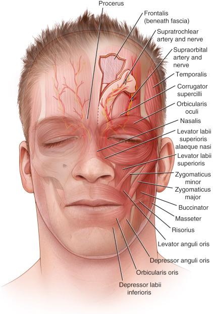 Figure 31.1, Forehead flap.