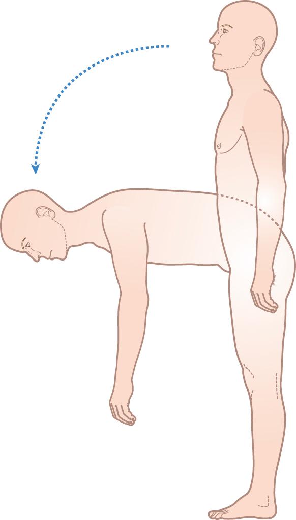 Figure 15.1, Inspect patient from behind and side, observing for normal spinal curves, then ask the patient: ‘bend forwards to try to touch your toes’.