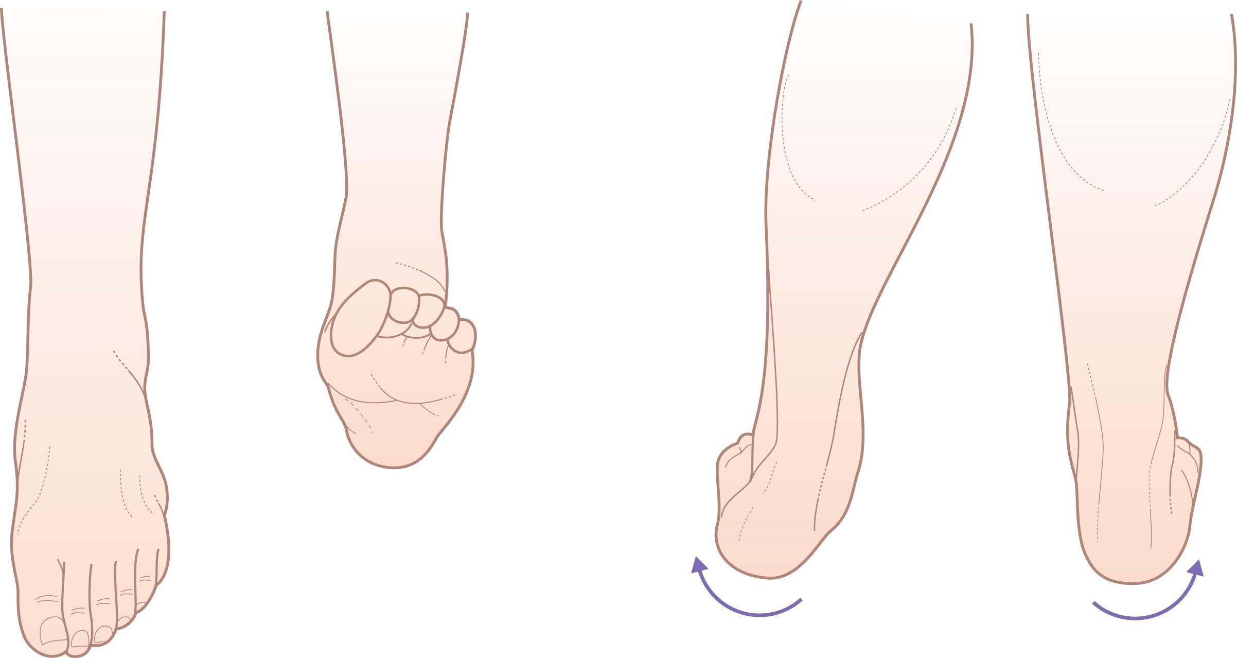 Figure 15.13, Test subtalar and ankle movement.