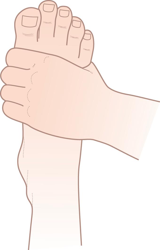 Figure 15.14, Squeeze across metacarpophalangeal (MTP) joints and inspect the soles of the feet.