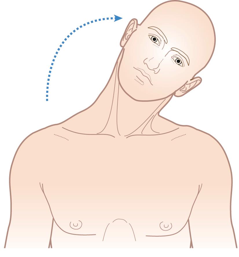 Figure 15.2, From the front, ask the patient: ‘place your ear on your right then your left shoulder’.
