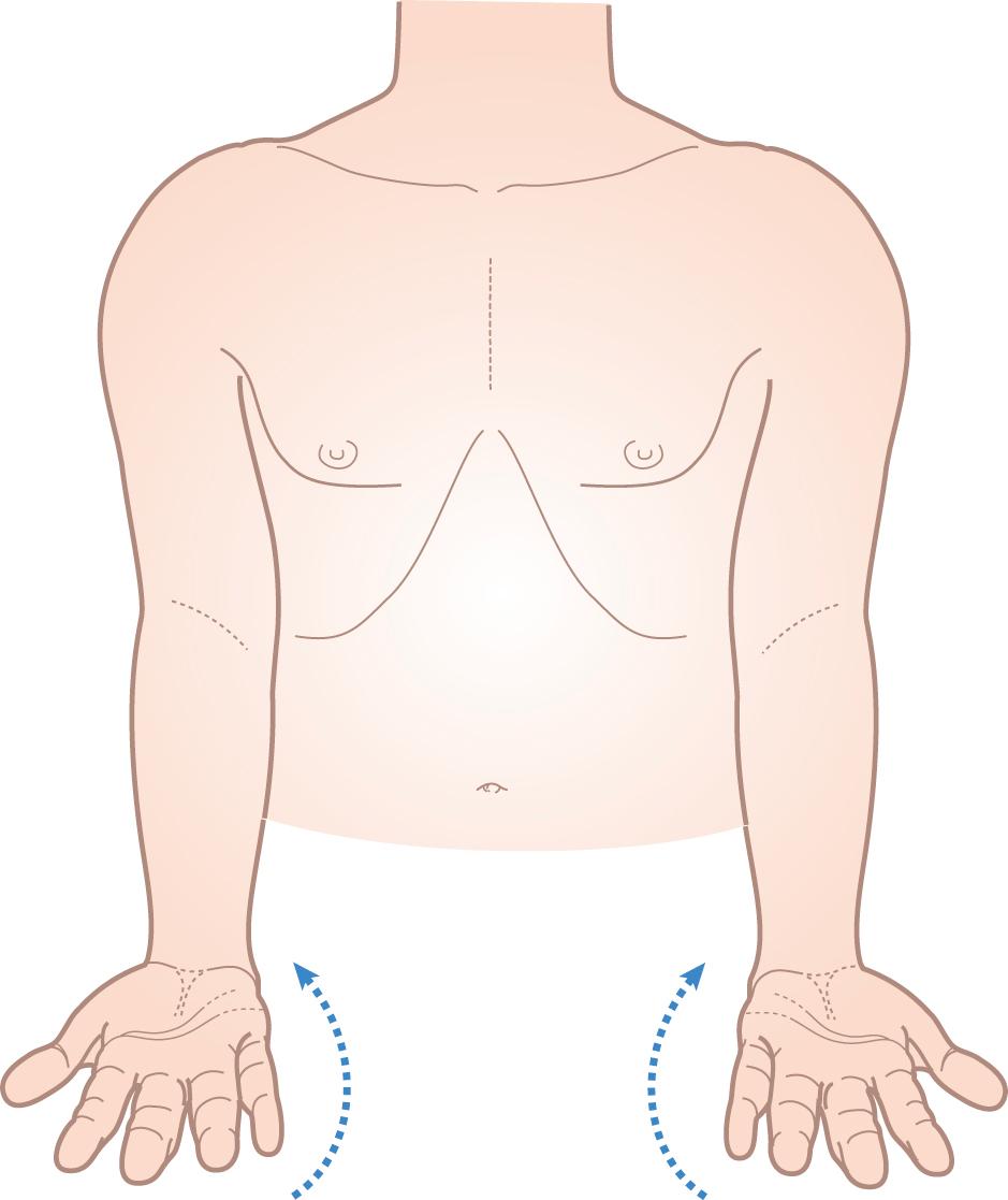 Figure 15.5, Ask the patient: ‘Put your hands out, palms down, and then turn your hands over’.