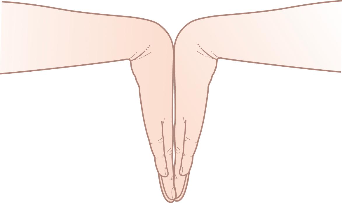 Figure 15.8, Ask the patient: ‘Do the same with your hands back to back’.