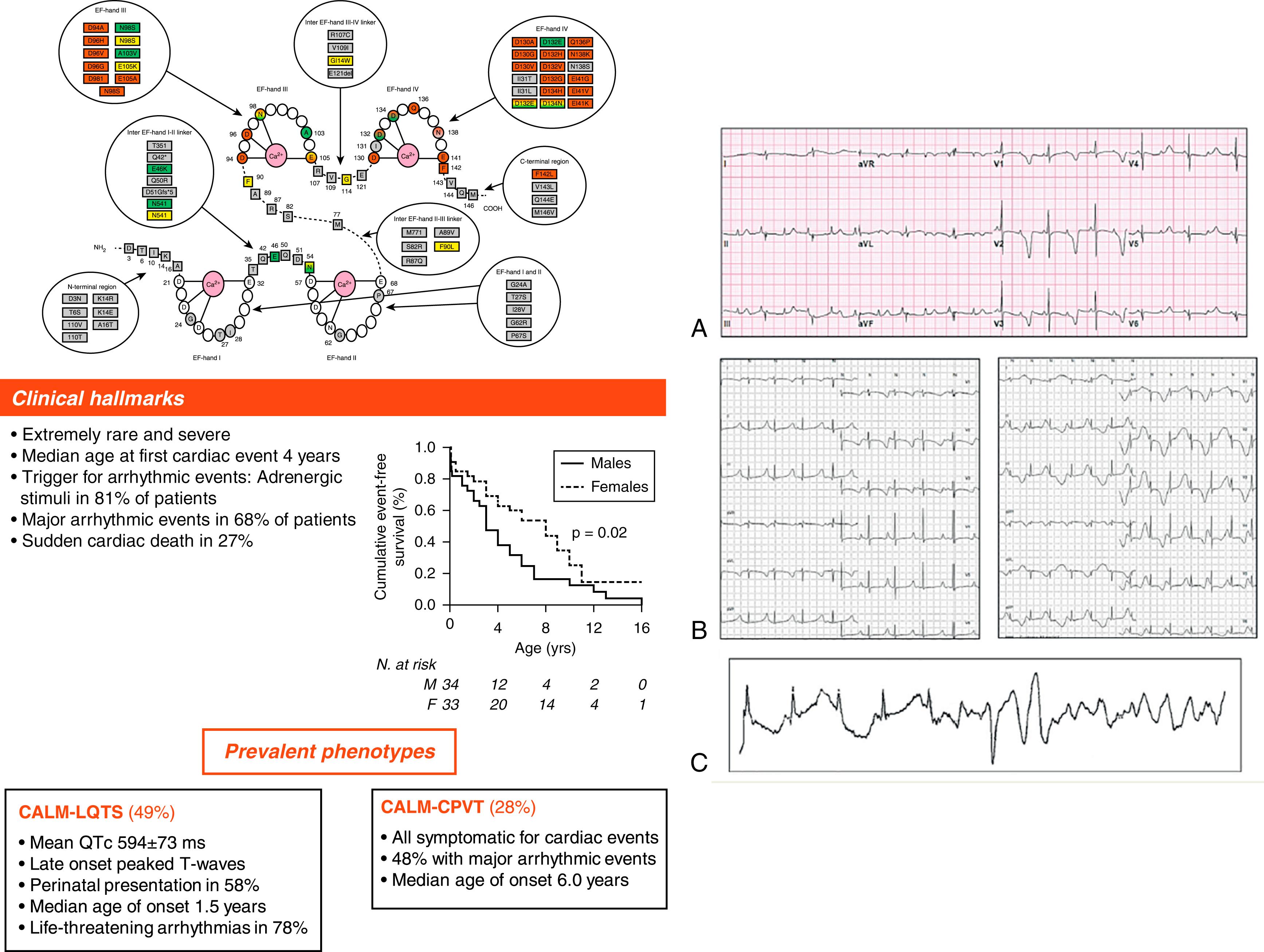 Fig. 96.2, Top left, Schematic model of calmodulin with the 4 Ca 2+ binding loops (EF hands I-IV) and amino acids principally involved in the binding of Ca 2+ ions denoted with gray lines . Colored amino acid residues (circles in EF hands and squares in linkers and N-/C- terminal regions) represent positions affected by genetic variants, identified either in patients of the International Calmodulinopathy Registry or in subjects of the general population (gnomAD database 146 ). All amino acid changes so far identified are listed in circles according to a color code for the associated phenotype: red for long QT syndrome (LQTS); green for catecholaminergic polymorphic ventricular tachycardia (CPVT); yellow for idiopathic ventricular fibrillation (IVF), sudden unexplained death (SUD), or atypical phenotype; and gray for variants identified in the gnomAD database. The corresponding amino acid positions in the protein are highlighted with the same color code. Shaded colors stand either for overlap phenotype or for an association with multiple distinct phenotypes. Bottom left, Clinical hallmarks in patients enrolled in the Registry. (A–C) Representative electrocardiograms (ECGs) of CALM-LQTS patients. (A) CALM3 -D130G, male, 4 days, 12-lead ECG showing markedly prolonged QTc and 2:1 atrioventricular block. (B) CALM1 -D130G, female, 2 years, Holter recording showing markedly prolonged QTc and phases of T wave alternans. (C) Holter ECG showing the VF onset in a CALM-LQTS, CALM1 -D130G, female, 9 months.