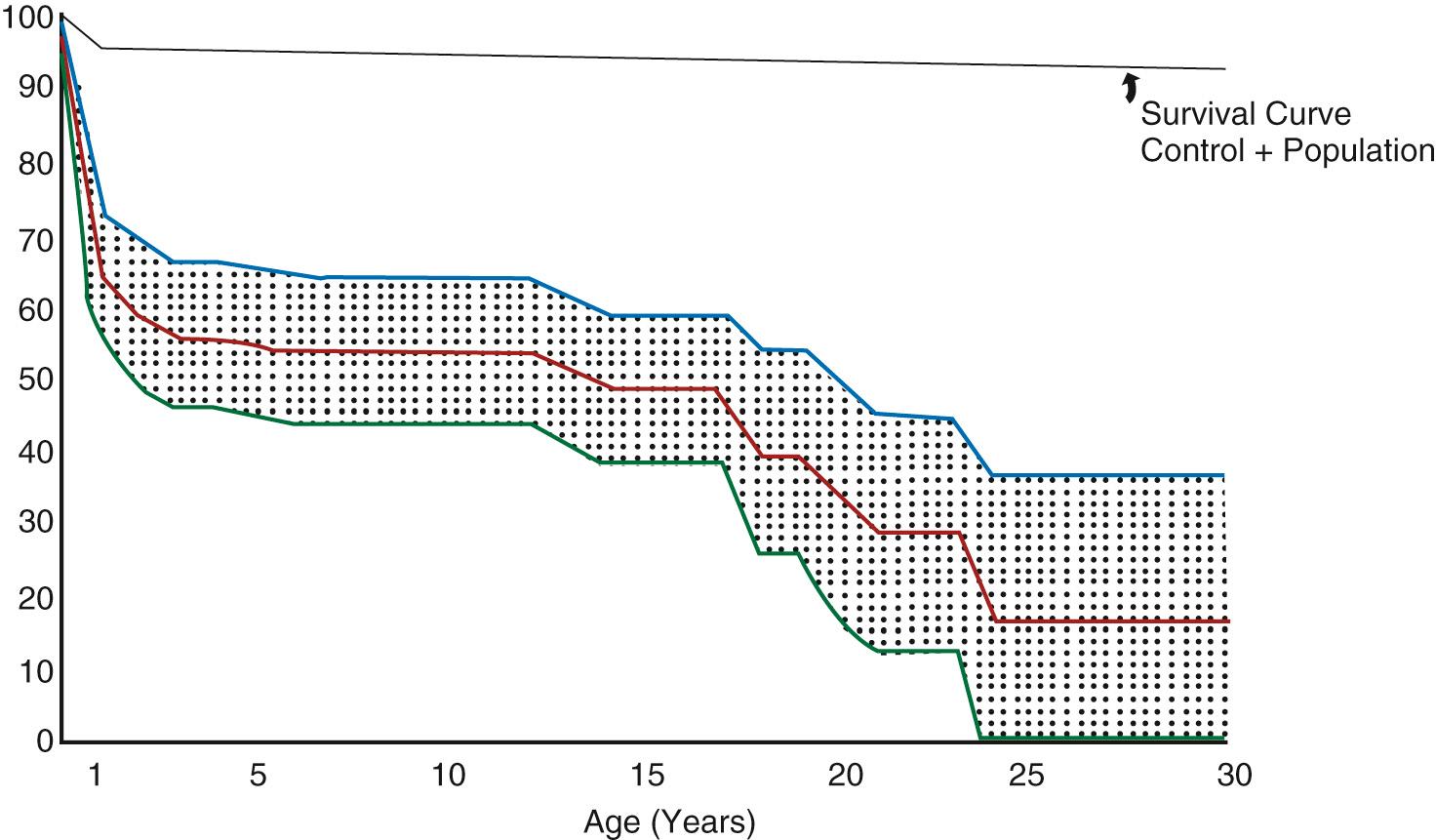 Fig. 73.1, Survival curve and 95% confidence intervals of 101 patients with tricuspid atresia born after 1940 and examined at the Children's Hospital Medical Center, Boston.