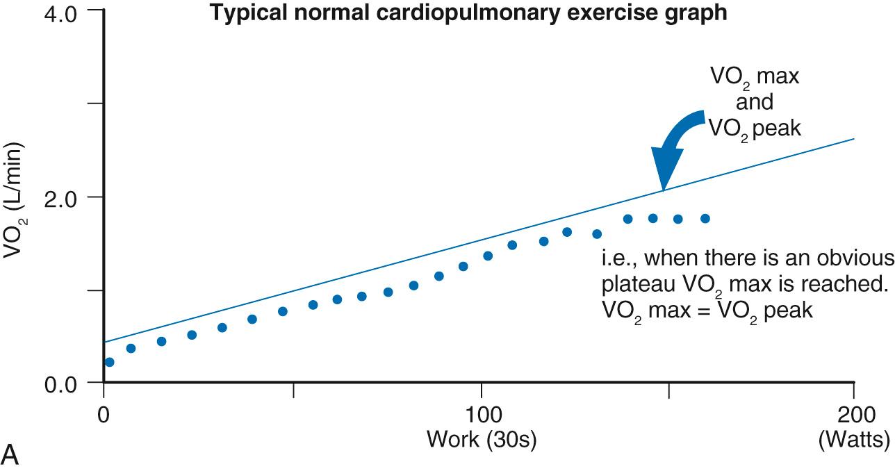 Fig. 73.8, Work versus oxygen uptake ( VO 2 ) during exercise. In the normal circulation (A) there is a point above which VO 2 cannot be increased despite an increase in workload. This represents the maximal VO 2 (VO 2 max), which in this situation is identical to VO 2 peak. In the Fontan circulation (B) exercise duration workload and VO 2 are reduced compared with normal and frequently there is no plateau in VO 2 , such that the VO 2 max is not achieved.