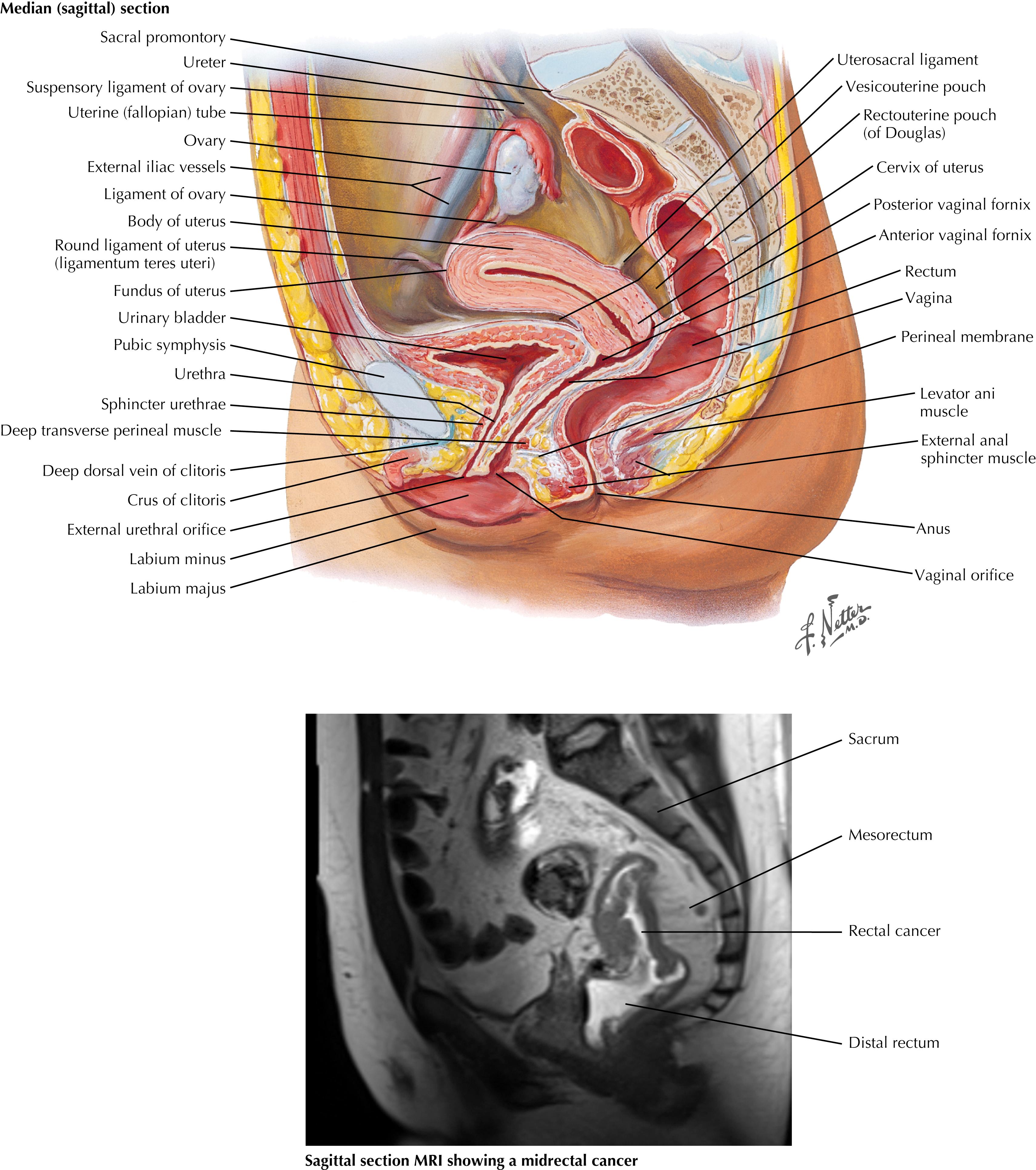 FIGURE 30.1, Pelvic viscera and perineum: female.