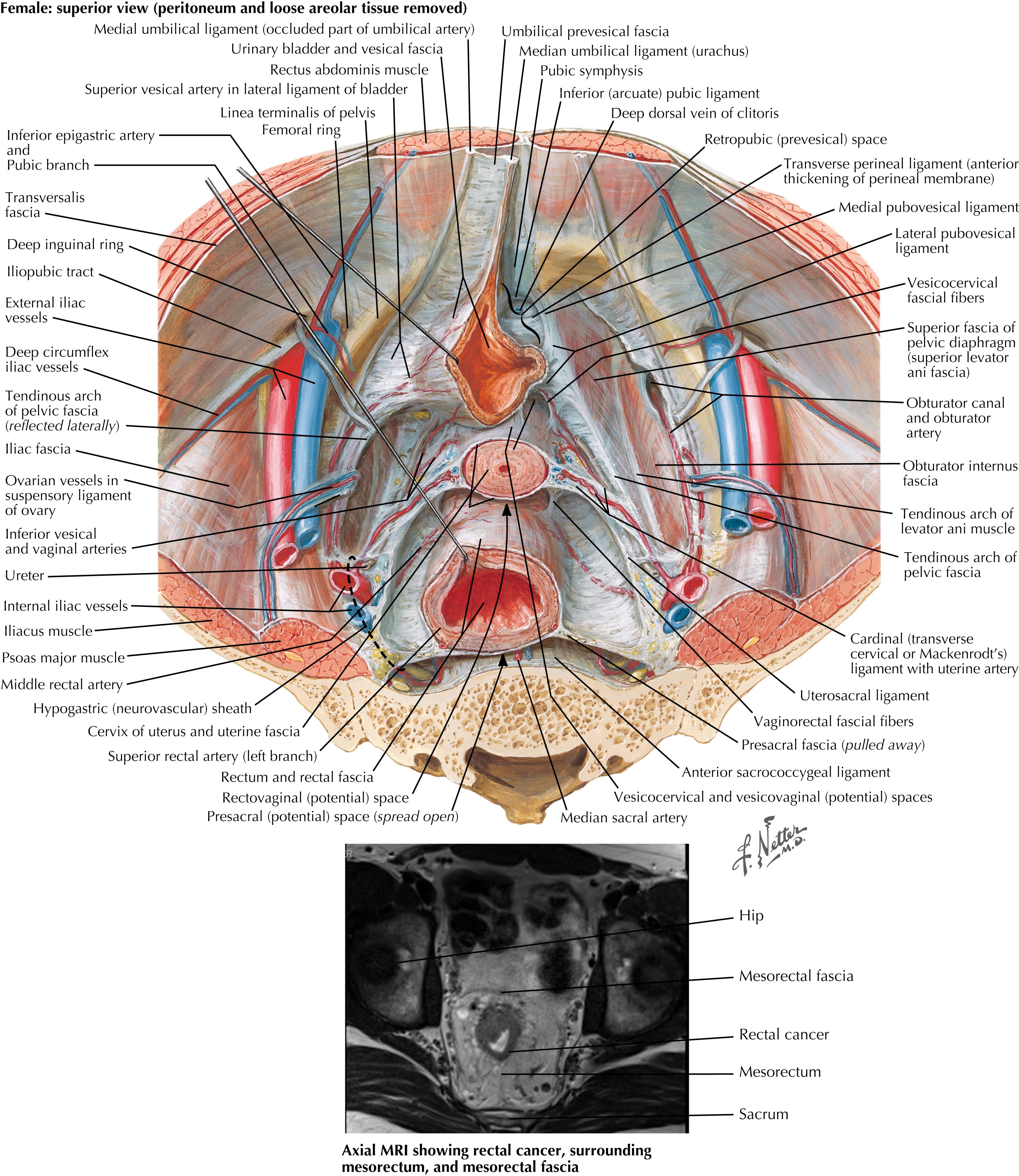 FIGURE 30.2, Endopelvic fascia and potential spaces: female.