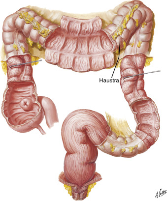 Fig. 21.2, The large bowel contains haustra, which are folds in the wall that create its segmented appearance.