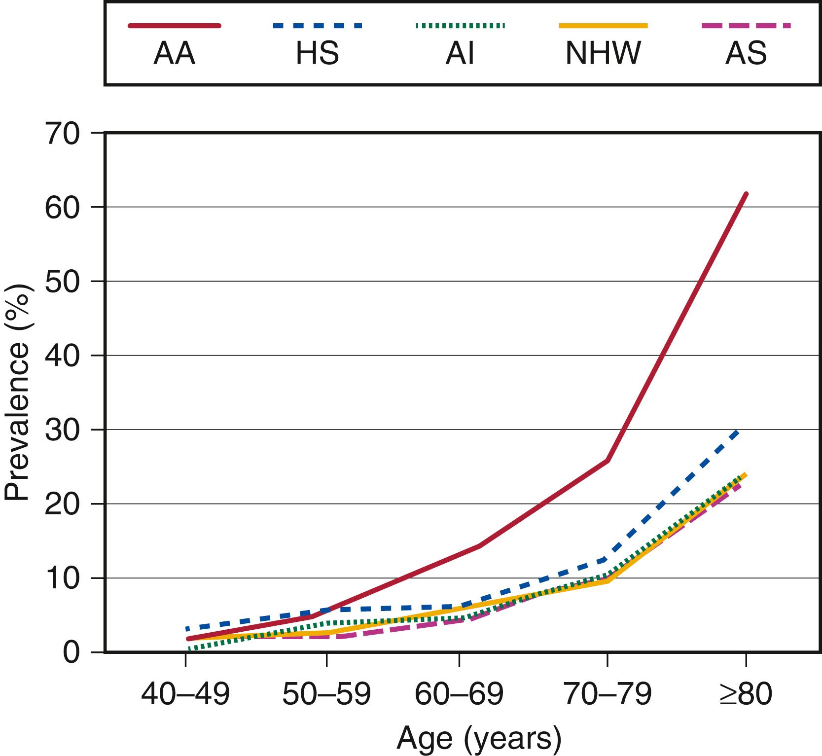 Figure 107.4, Estimated United States prevalence of PAD by age and ethnicity. AA , African American; AI , American Indian; AS , Asian American; HS , Hispanic; NHW , non-Hispanic white.