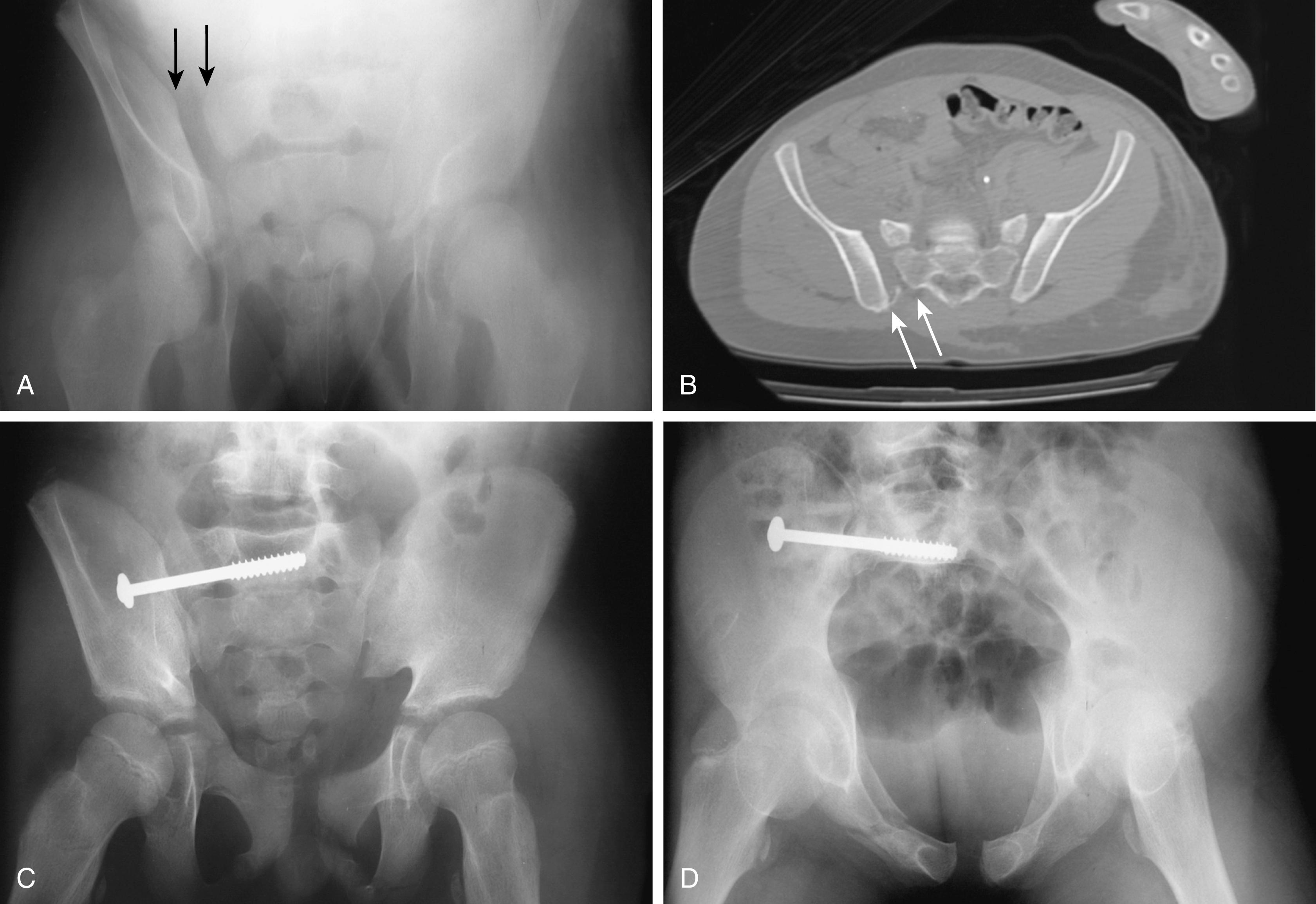 Lower Extremity Injuries - Clinical Tree