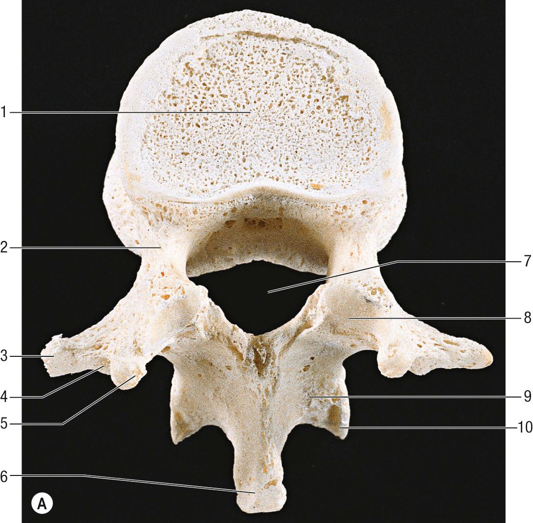 Fig. 34.1, A , The first lumbar vertebra, superior aspect. Key: 1, body; 2, pedicle; 3, transverse process; 4, accessory process; 5, mammillary process; 6, spinous process; 7, vertebral foramen; 8, superior articular facet; 9, lamina; 10, inferior articular facet. B , A lateral radiograph of the lumbar spine, 24-year-old male. Key: 1, L3 transverse process; 2, L4 pedicle; 3, twelfth rib; 4, L2 superior articular facet; 5, L2 spinous process; 6, L3/4 intervertebral foramen.