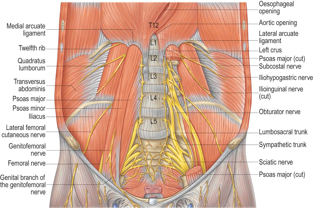 Fig. 34.6, Muscles and nerves of the posterior abdominal wall (the left psoas major has been removed to expose the origins of the lumbar plexus and quadratus lumborum). Quadratus lumborum and psoas major are important anatomical landmarks during the lateral transpsoas approach.