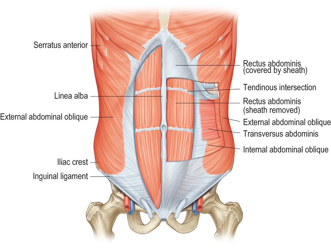 Fig. 34.7, The anatomy of the anterior abdominal wall, which is relevant for the anterior approach to the lumbosacral spine.