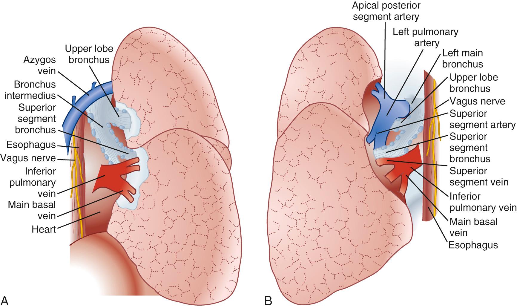 FIGURE 17-1, Posterior views of the right (A) and left (B) pulmonary hila. The mediastinal pleura is opened and the lung retracted anteriorly.