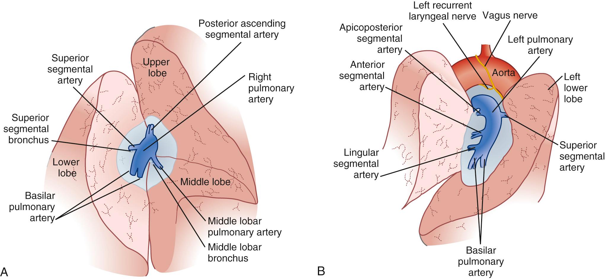 FIGURE 17-2, The interlobar views of the right (A) and left (B) lungs. The fissures are incised and pulmonary artery branches are exposed.