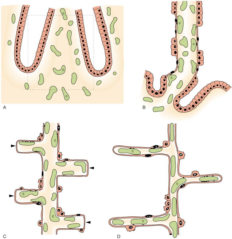 • Fig. 11.1, Diagram showing development of lung parenchyma and its microvasculature. A, Pseudoglandular stage, during which epithelial tubes lined by columnar epithelial cells invade the mesenchyme, which contains a loose network of blood capillaries (C). The remaining panels show further development of structures enclosed by the frame in A . B, Canalicular stage, showing differentiation of ‘airspace’ epithelium and expansion of airspaces resulting in attenuation of mesenchyme; capillaries are rearranged around the epithelial tubes so that walls between ‘airspaces’ contain a double layer of capillaries. A thin ‘air’–blood interface develops, and types I and II epithelial cells become apparent. C, Terminal sac and alveolar stages, showing development of secondary septa from primary septa; septa are primitive in that they contain a double capillary network and a central layer of connective tissue. D, Mature lung, showing thin interalveolar walls containing a single capillary layer.