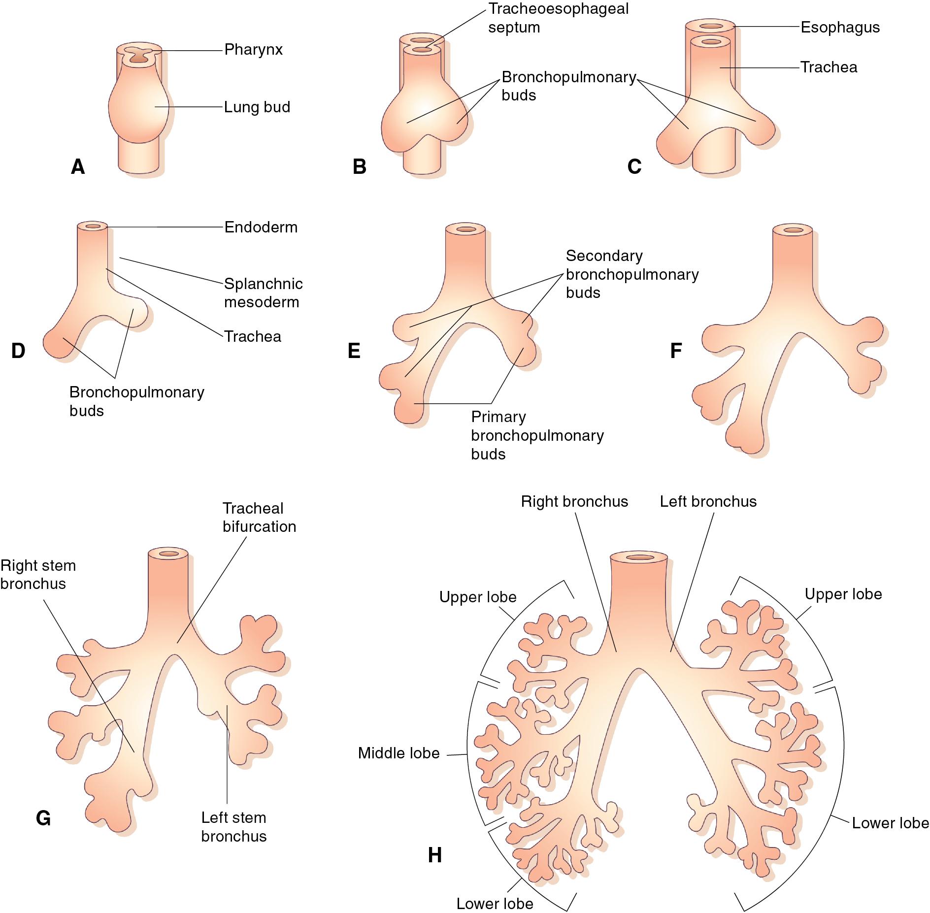 Figure 1.1, Diagrammatic representation of the successive stages in the development of the bronchi and lungs: (A–D) 4 weeks; (E and F) 5 weeks; (G) 6 weeks; (H) 8 weeks.