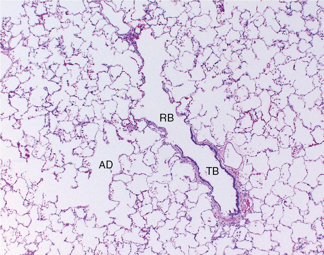 Figure 1.4, The mature lung lobule consists of terminal bronchioles with their respective respiratory bronchioles, alveolar ducts, and alveolar sacs. Here the Y-shaped division of the terminal bronchiole into respiratory bronchioles and alveolar ducts can be seen in the lung of a child. AD , Alveolar duct; RB , respiratory bronchiole; TB , terminal bronchiole.