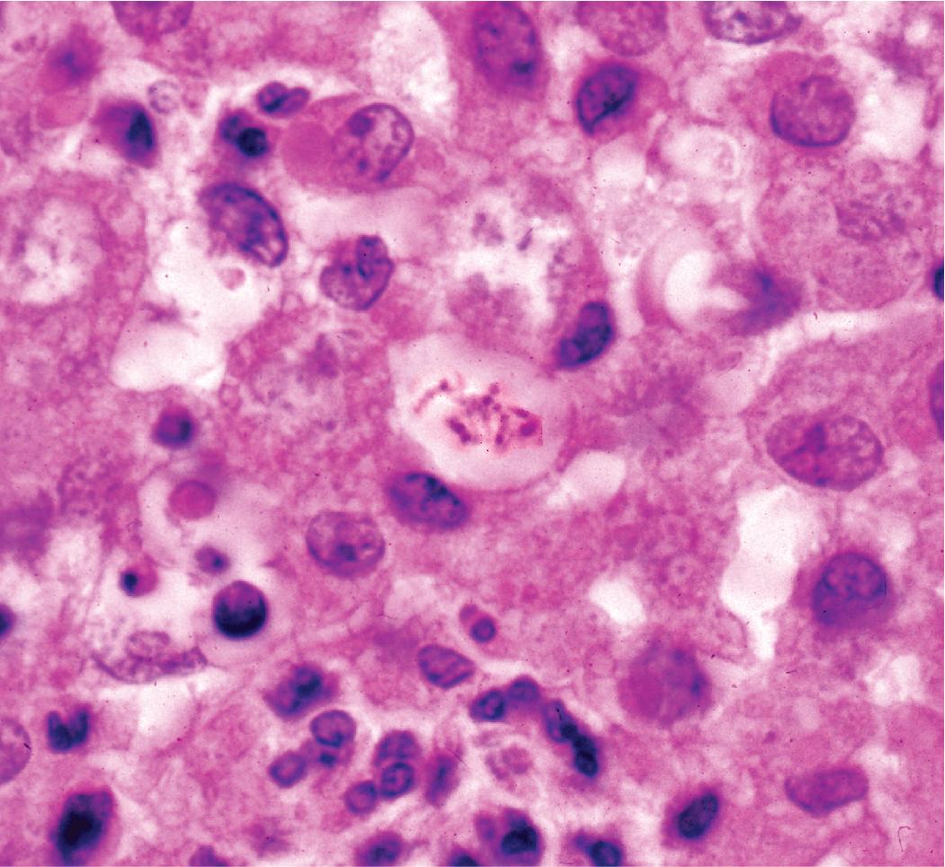 Figure 7.15, Rhodococcus equi bacilli in macrophage.