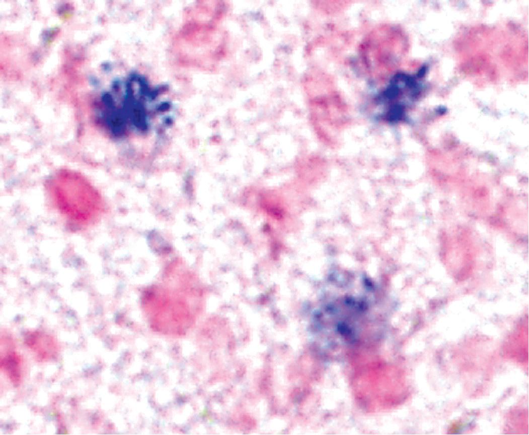 Figure 7.25, Legionnaire’s disease. Detection of organisms by in situ DNA hybridization.