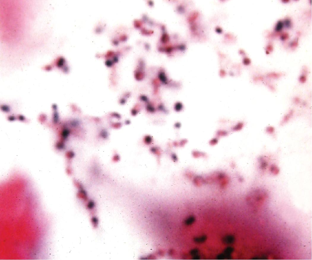 Figure 7.30, Yersinia pestis bacilli in alveolar space.