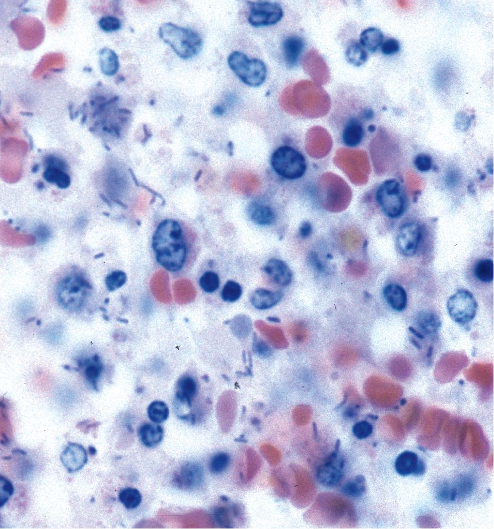 Figure 7.5, Bacillary organisms in alveolar exudate (Giemsa stain).