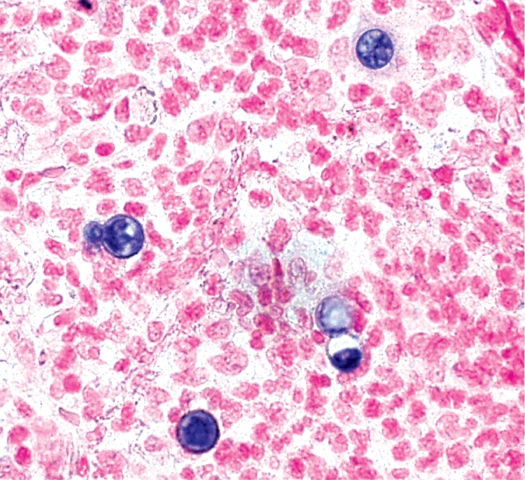 Figure 7.10, Blastomyces dermatitidis . In situ hybridization.