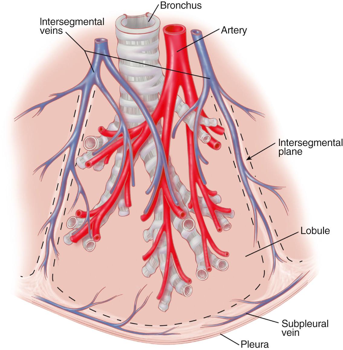 Fig. 47.3, Anatomy of a bronchopulmonary segment. Note that the draining pulmonary vein circulates in the intersegmental plane marking the boundaries of the segment.