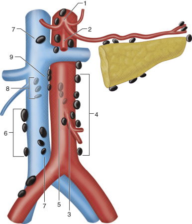 Figure 61-2, Illustration of the retroperitoneum depicting the retroperitoneal lymph nodes: 1, celiac; 2, superior mesenteric; 3, inferior mesenteric; 4, para-aortic; 5, retroaortic; 6, paracaval; 7, precaval; 8, retrocaval; 9, aortocaval.