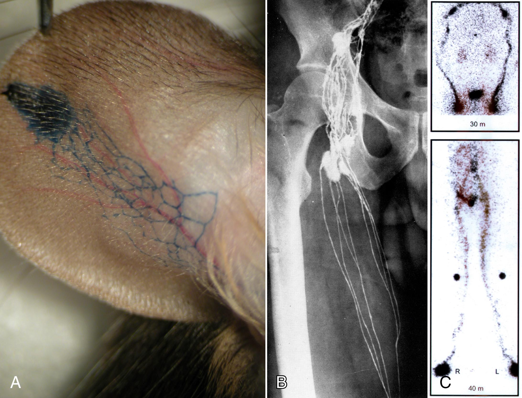 Figure 10.7, Imaging Techniques to Delineate the Structure and Function of the Lymphatic System.