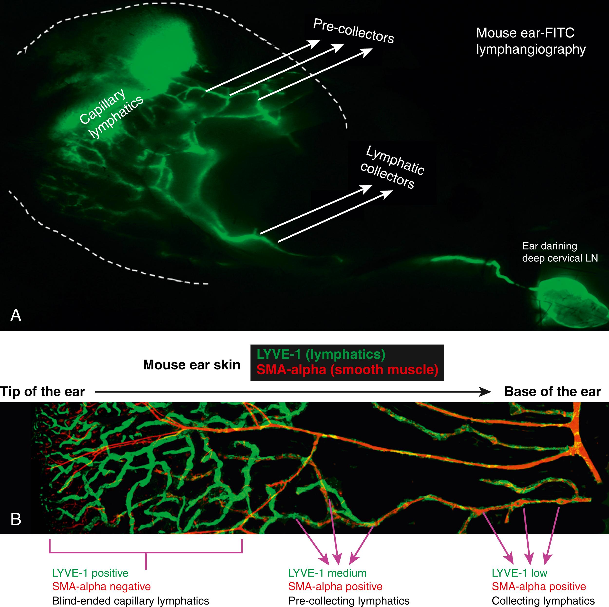 Fig. 44.1, Microscopic anatomy of lymphatic drainage system in a mouse ear model. (A) Drainage from capillary lymphatics to pre-collectors to collectors to lymph node on fluorescein isothiocyanate (FITC) lymphangiography. (B) Staining of mouse ear skin with lymphatic vessel endothelial hyaluronan receptor 1 (LYVE-1) and smooth muscle actin, alpha (SMA-alpha) showing a progressively increasing number of smooth muscle cells along the drainage pathway from capillary lymphatics to pre-collecting lymphatics to collecting lymphatics.