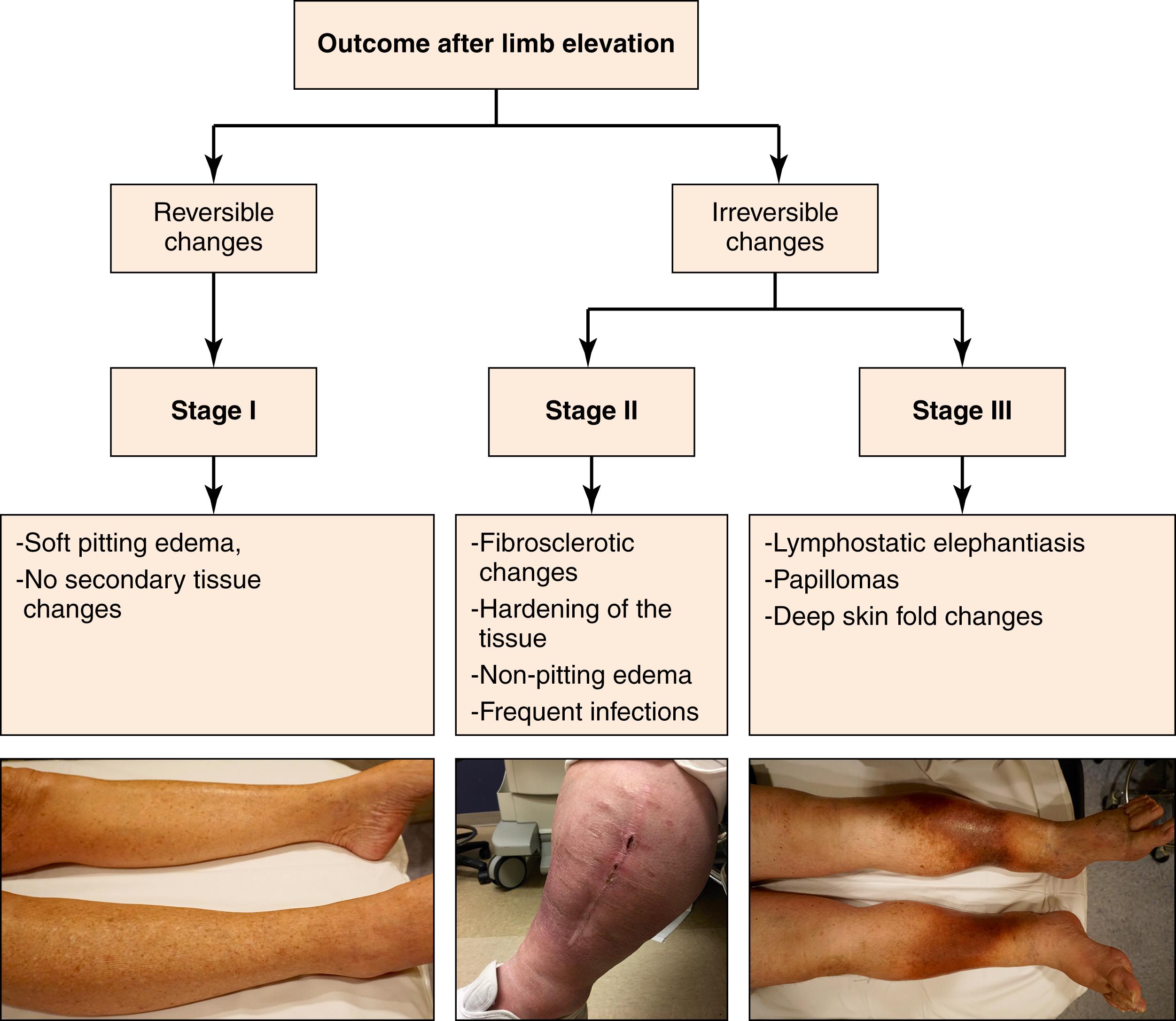 Figure 168.3, Diagnosis, Classification, and Clinical Features.